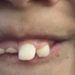 Meet your Posher, Alfredo